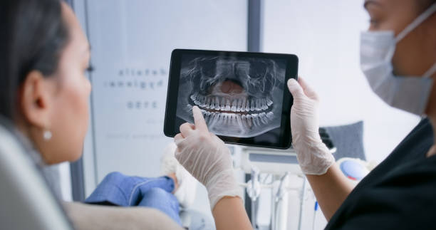 Licensed Tooth Extraction service in Lewiston, MN - Smile Center Dentistry